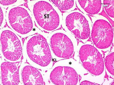 A B Light Photomicrographs Of Rat Testis Treated With Bpa Gii