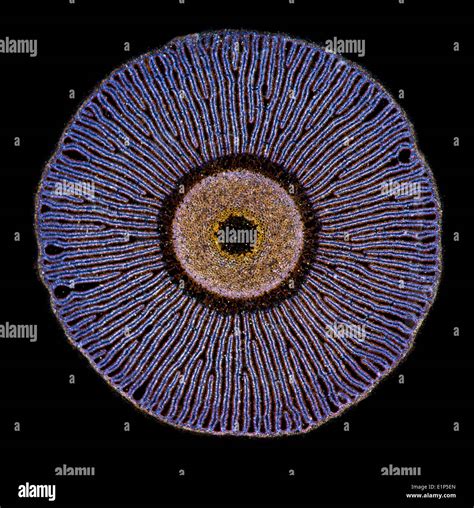 Coprinus Hyphae: Microscopic Exploration Revealed