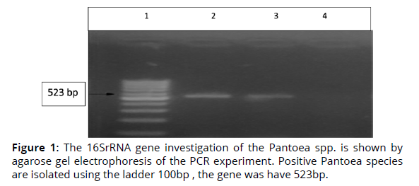 Detection Of Three Pantoea Spp In Artificially Infected Rice Leaves Detection Of Three Pantoea Spp In Artificially Infected Rice Leaves