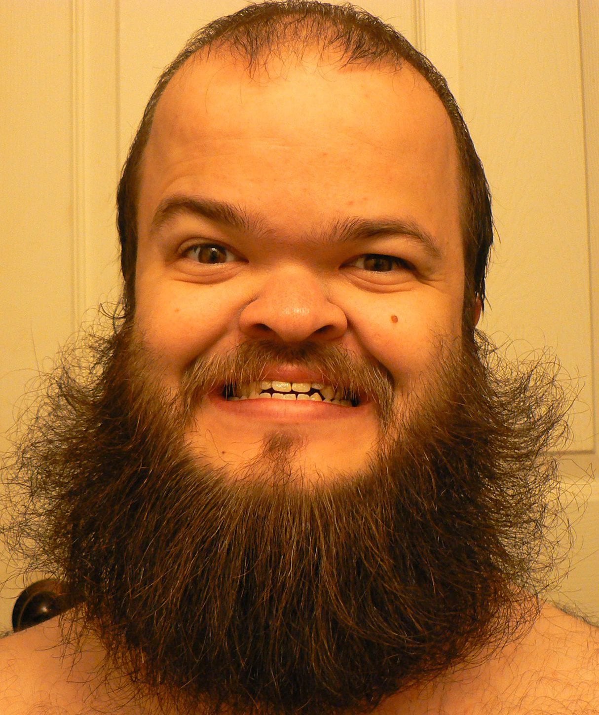 Dwarven Beard Grown By A Real Dwarf Pics