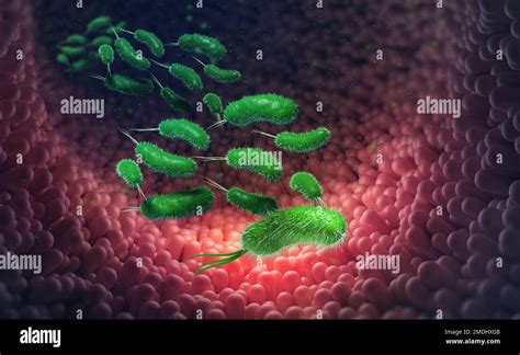 Escherichia Coli Germs And Viruses In Body Bowel Infection Upset