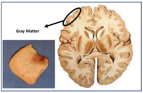 Gray Matter In Brain Fasrevery