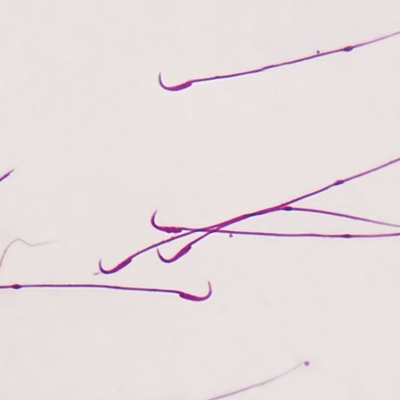 Mammal Rat Sperm Smear Microscope Slide Carolina Com