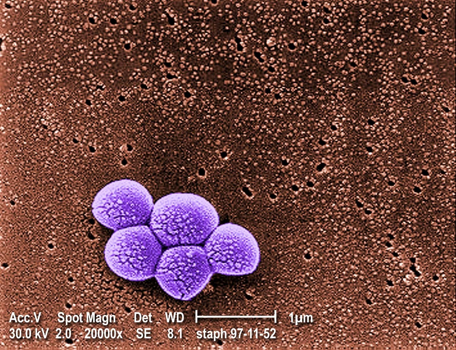 Mrsa Methicillin Resistant Staphylococcus Aureus Tcps