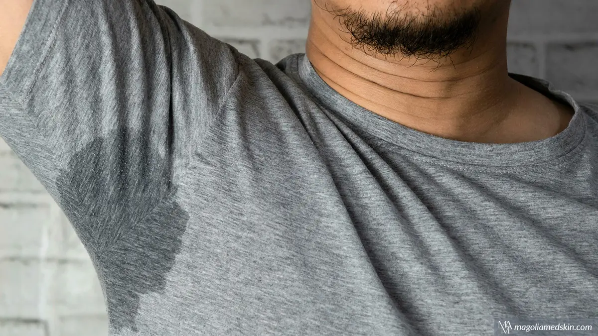 Natural Overactive Sweat Gland Solution Take Control Of Sweating