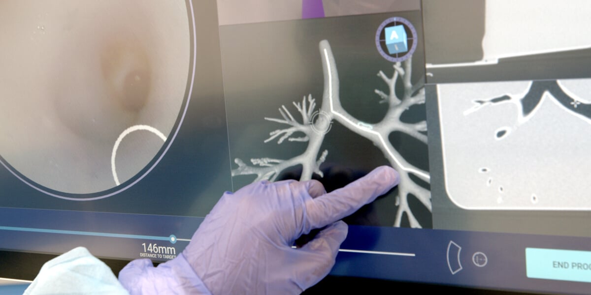 Noah Medical Presents Data Showcases The Galaxy System At Chest