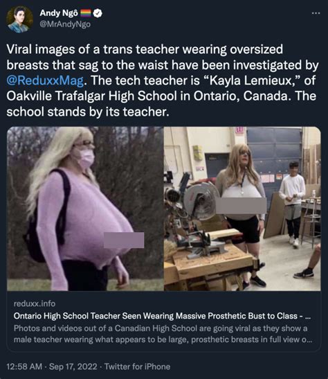 Ontario High School Teacher Kayla Lemieux S Prosthetic Boobs