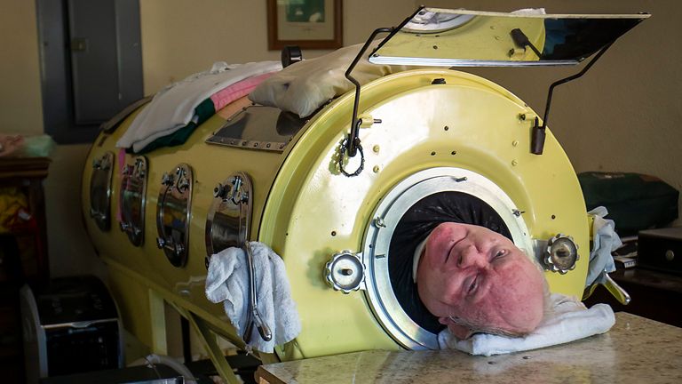 Paul Richard Alexander Living In An Iron Lung For 70 Years Malevus