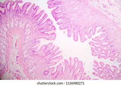 Stomach Acid Under Microscope: Surprising Insights Revealed