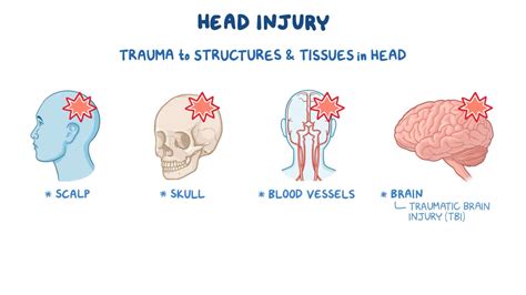 Understanding Head Injuries Harvard Health