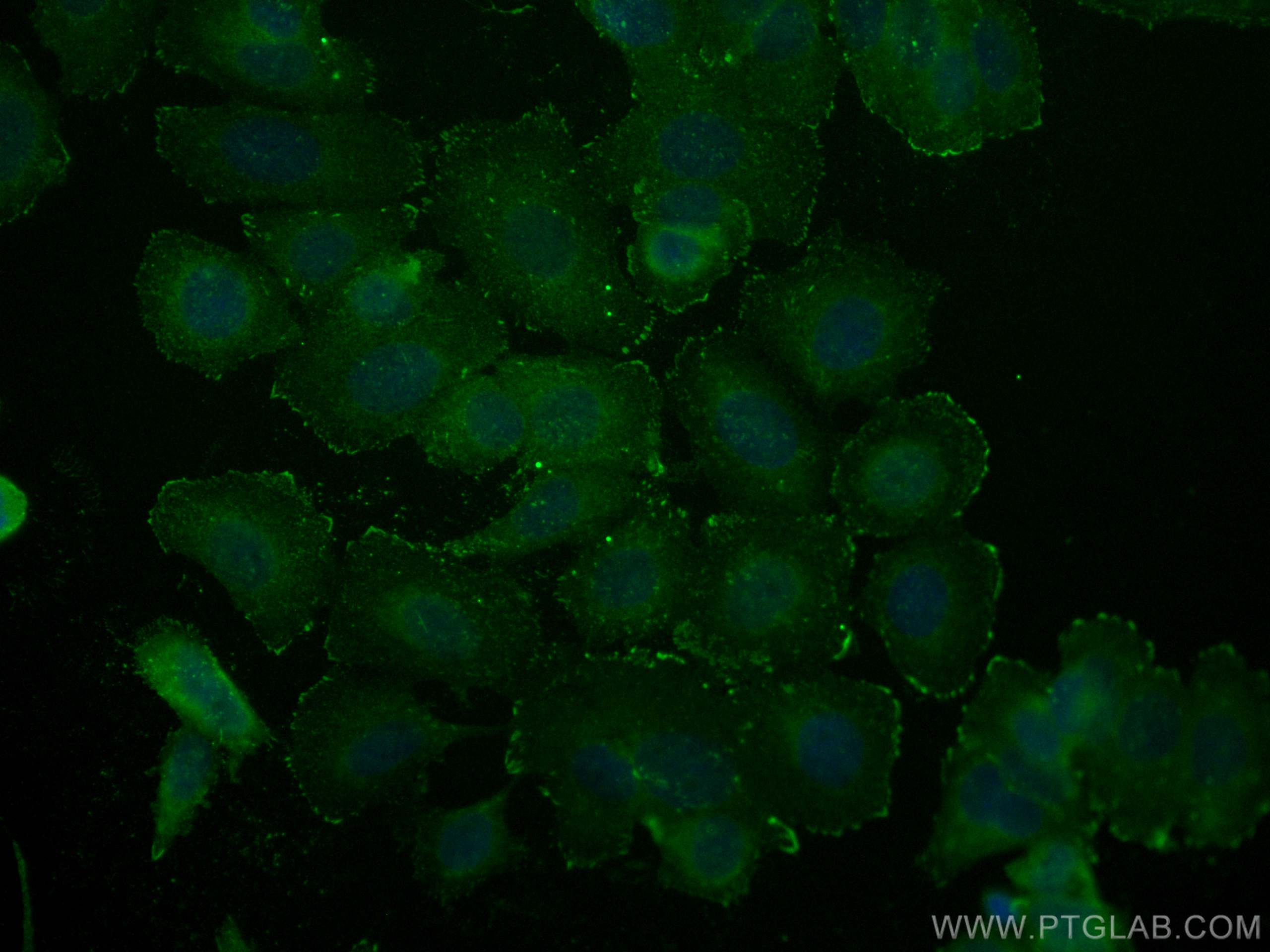 V Integrin Gene Deletion Analysis A Diagram Of The V Integrin Locus