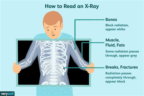 Understanding Tunability in X-Rays: A Simple Guide  
What is Tunability in X-Rays? Explained Easily  
Tunability in X-Rays: Key Concepts & Applications  
X-Ray Tunability: How It Works & Why It Matters  
Decoding Tunability in X-Rays: A Quick Overview